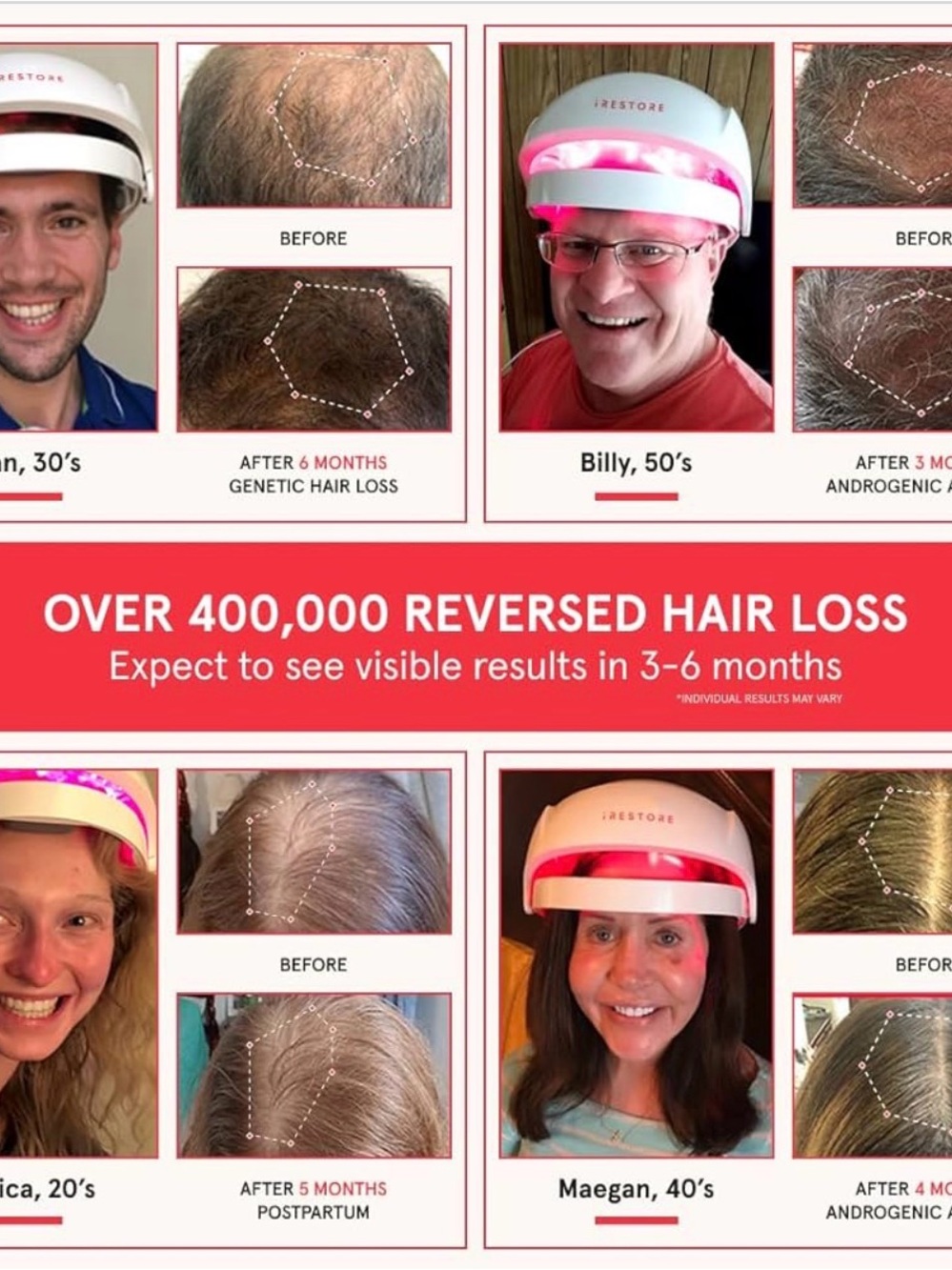 iRestore Essential - Laser Red Light Therapy for Hair Growth - FDA Cleared - Picture 2 of 2